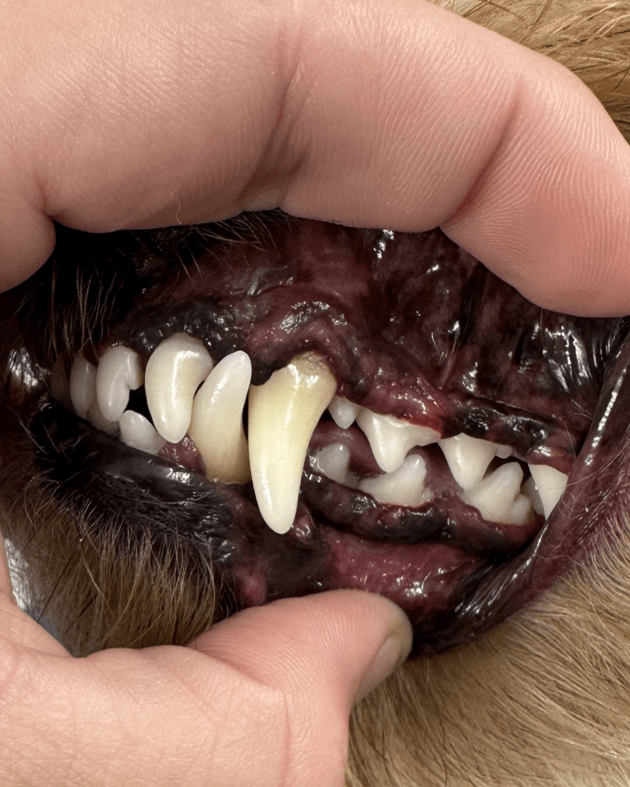 After teeth brushing — cleaner teeth