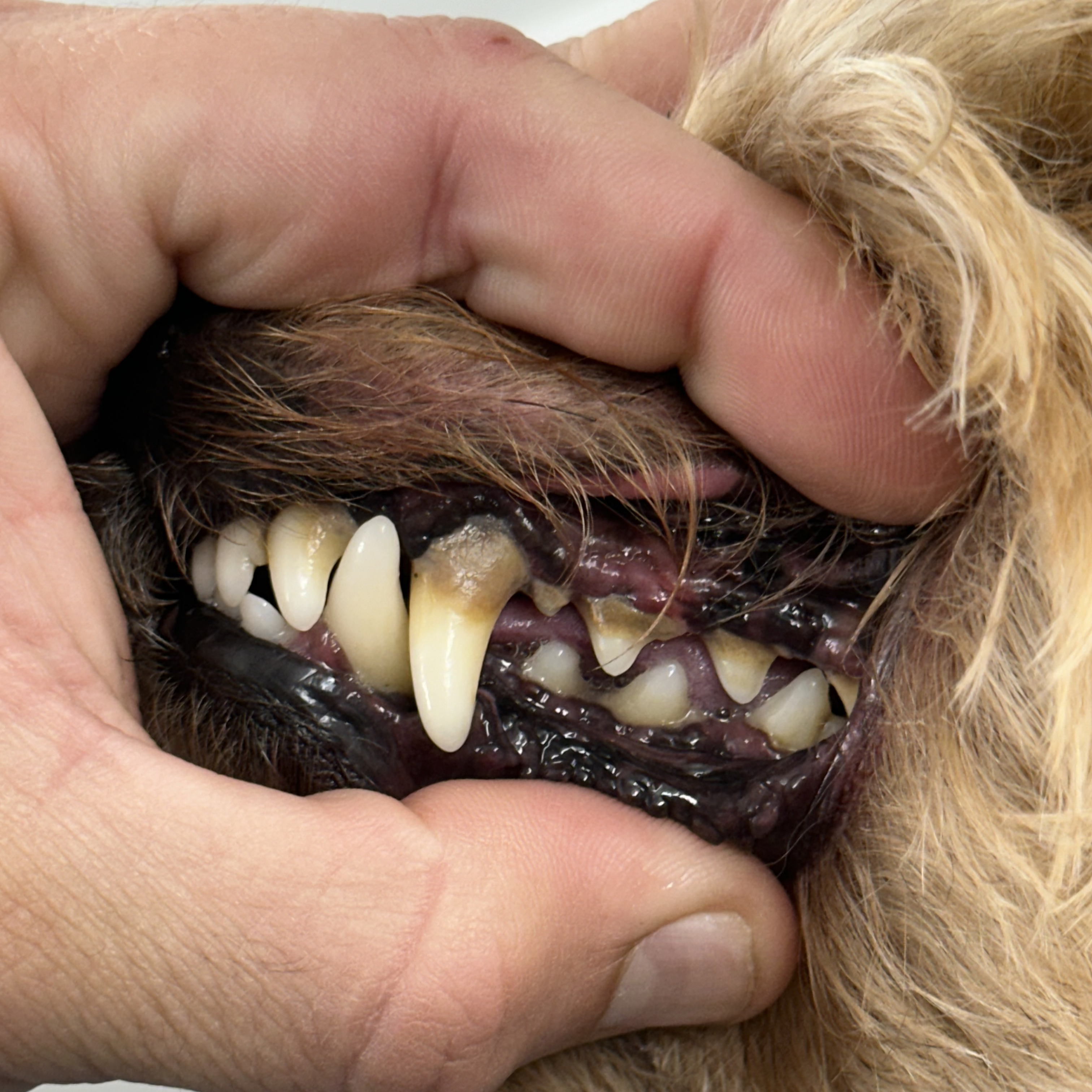 Before teeth brushing — plaque visible on teeth